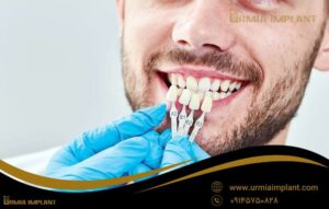 قیمت ایمپلنت دندان در ارومیه