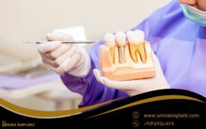 فرق ایمپلنت با دندان مصنوعی