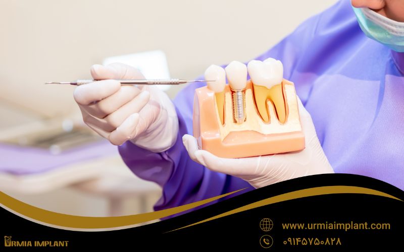 ویژگی های بهترین دندانپزشک در ارومیه