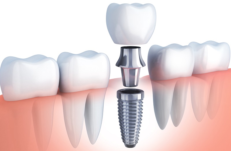 پروتکل‌ های بعد از جراحی