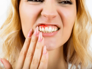 درمان خانگی عفونت ایمپلنت دندان