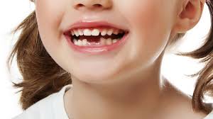افتادن زود هنگام دندان شیری