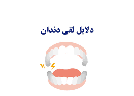 علت لق شدن دندانها88