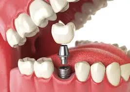 افزایش اعتماد به نفس