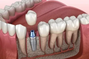 کاهش مشکلات گوارشی