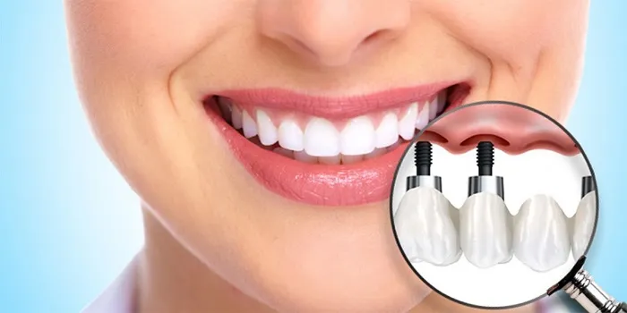 صفحه اصلی 72 آیا برای تمامی بیماران مناسب است