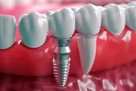 روش‌های جراحی کمتر تهاجمی