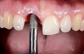 کاهش اضطراب و افسردگی