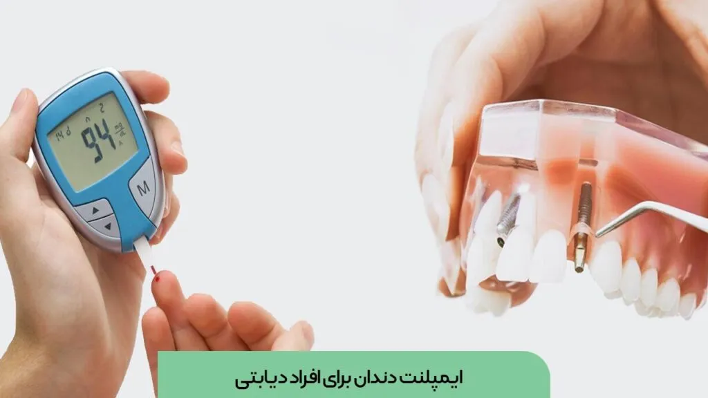 ایمپلنت در بیماران دیابتی