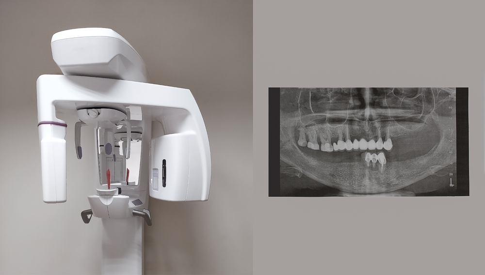آینده CBCT در دندانپزشکی
