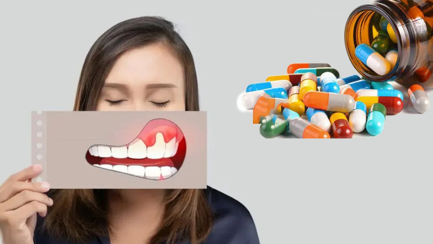 نقش آنتی بیوتیک ها در پیشگیری از عفونت ایمپلنت 2 درمان خانگی عفونت ایمپلنت